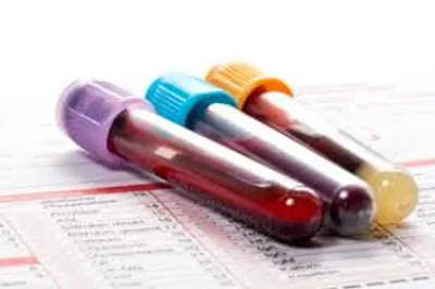 Blood test, blood samples on a laboratory form
